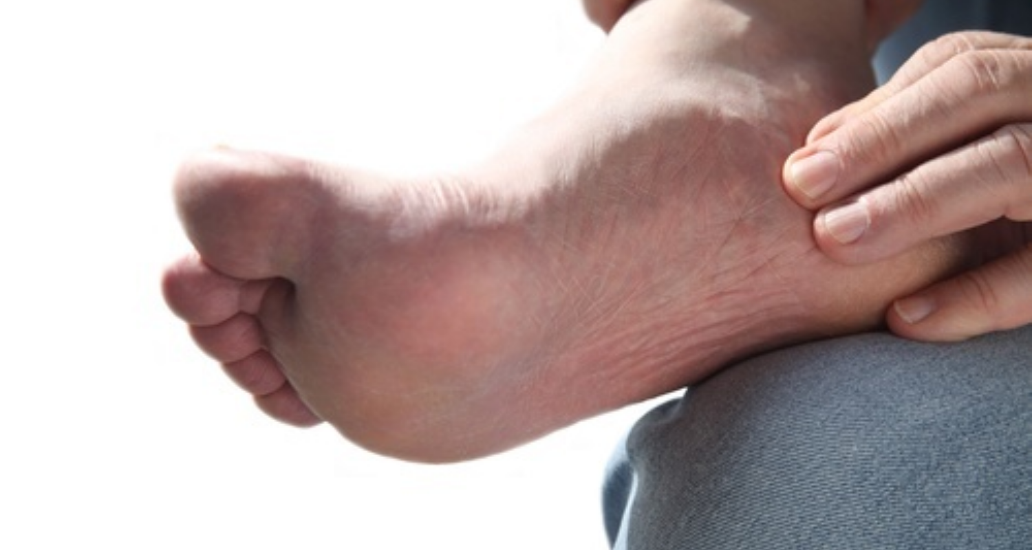 Dealing With and Preventing Plantar Fasciitis
