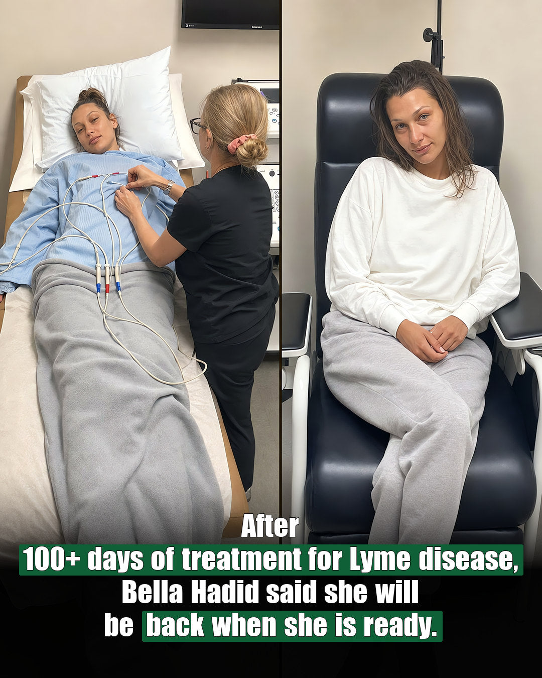 Bella Hadid Lyme disease recovery and pacing awareness